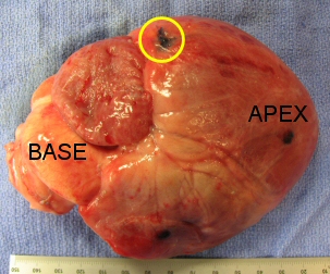 Injection Site