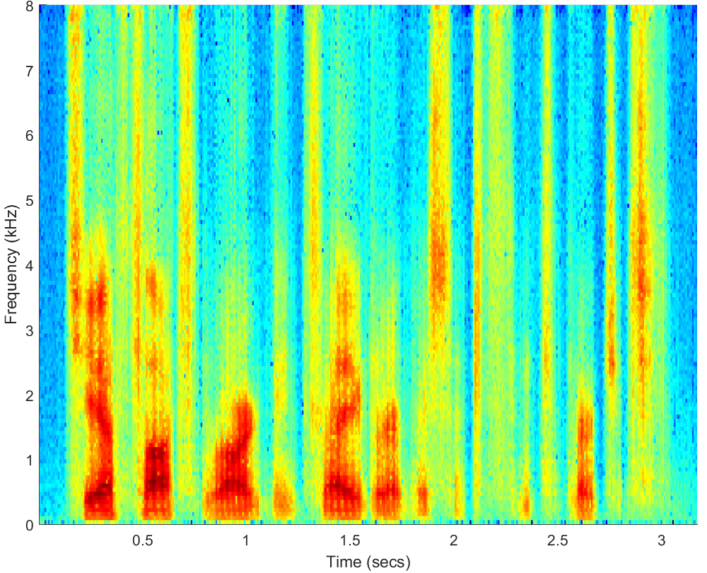 Spectrograms