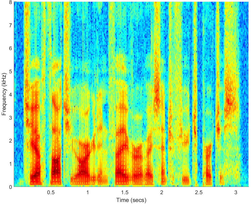 Spectrograms