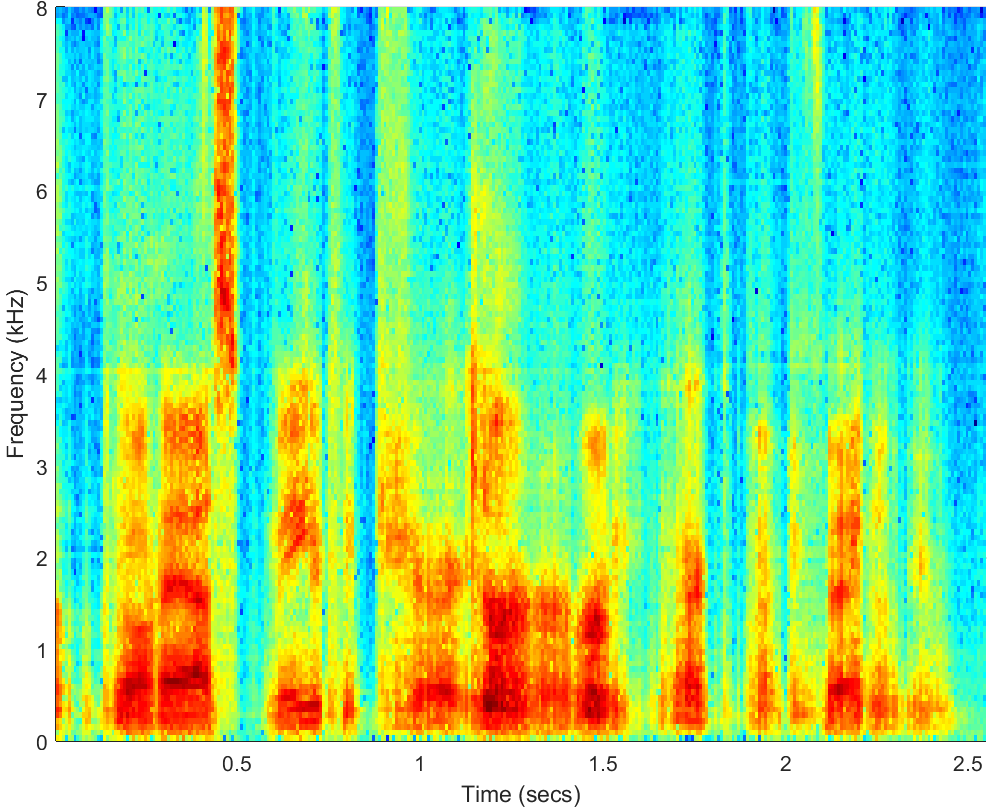 Spectrograms