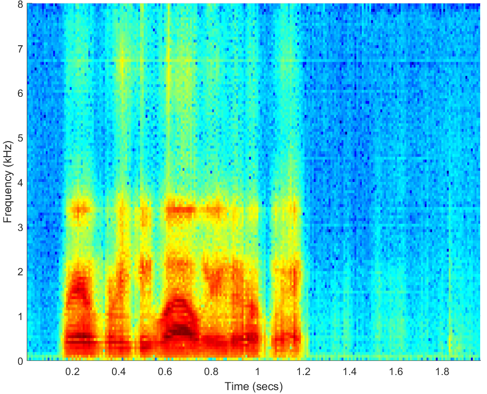 Spectrograms