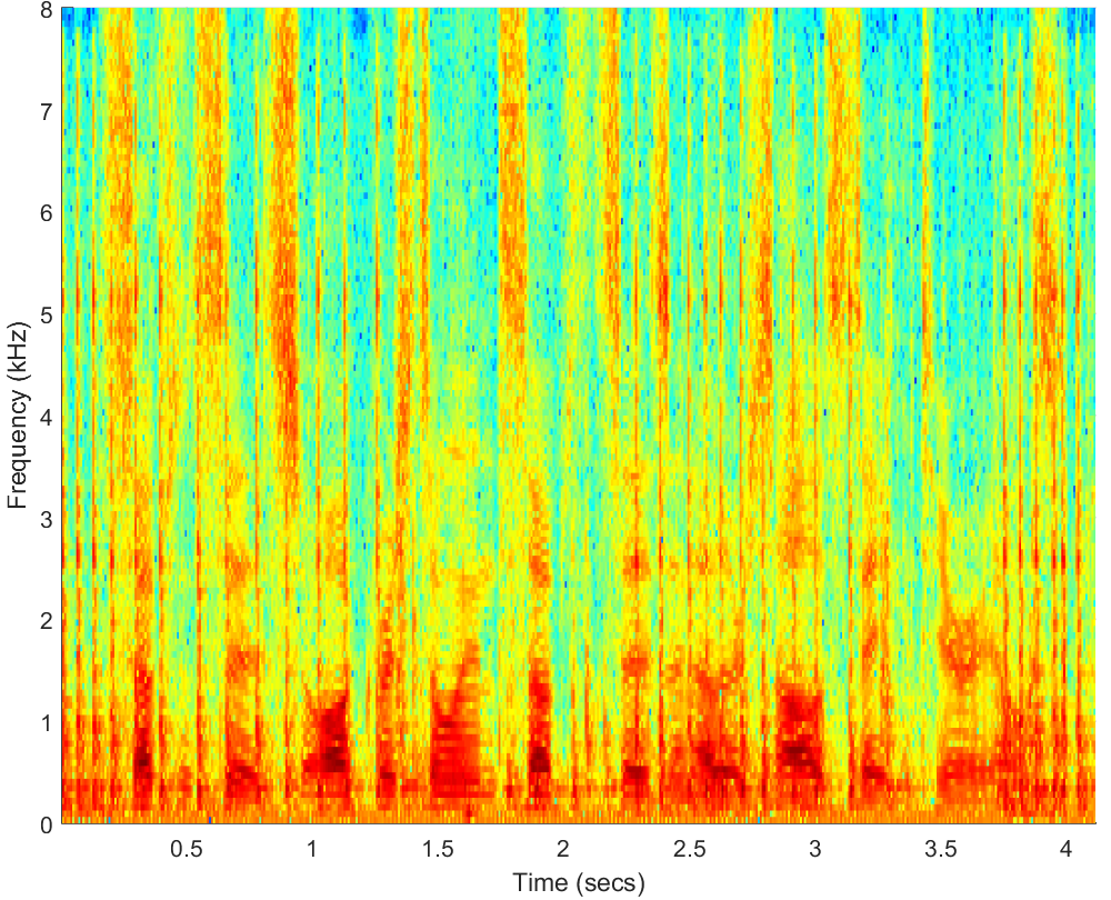 Spectrograms