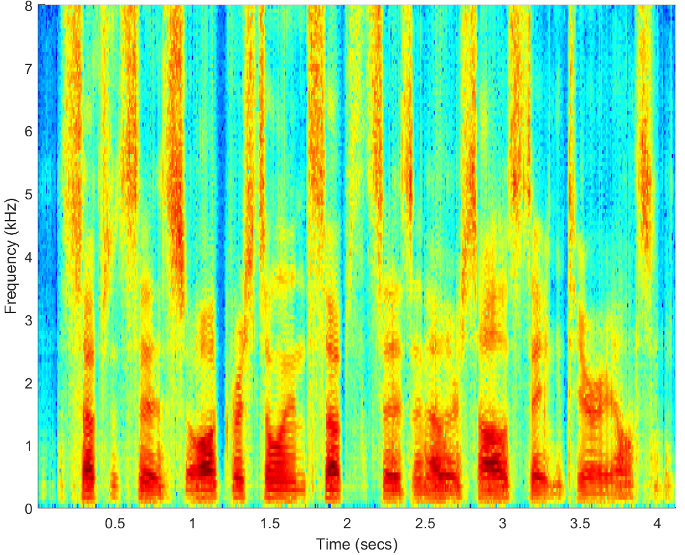 Spectrograms