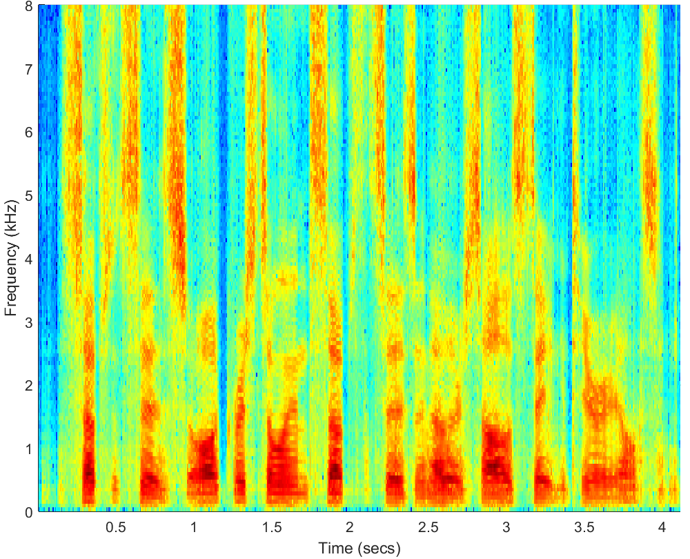 Spectrograms