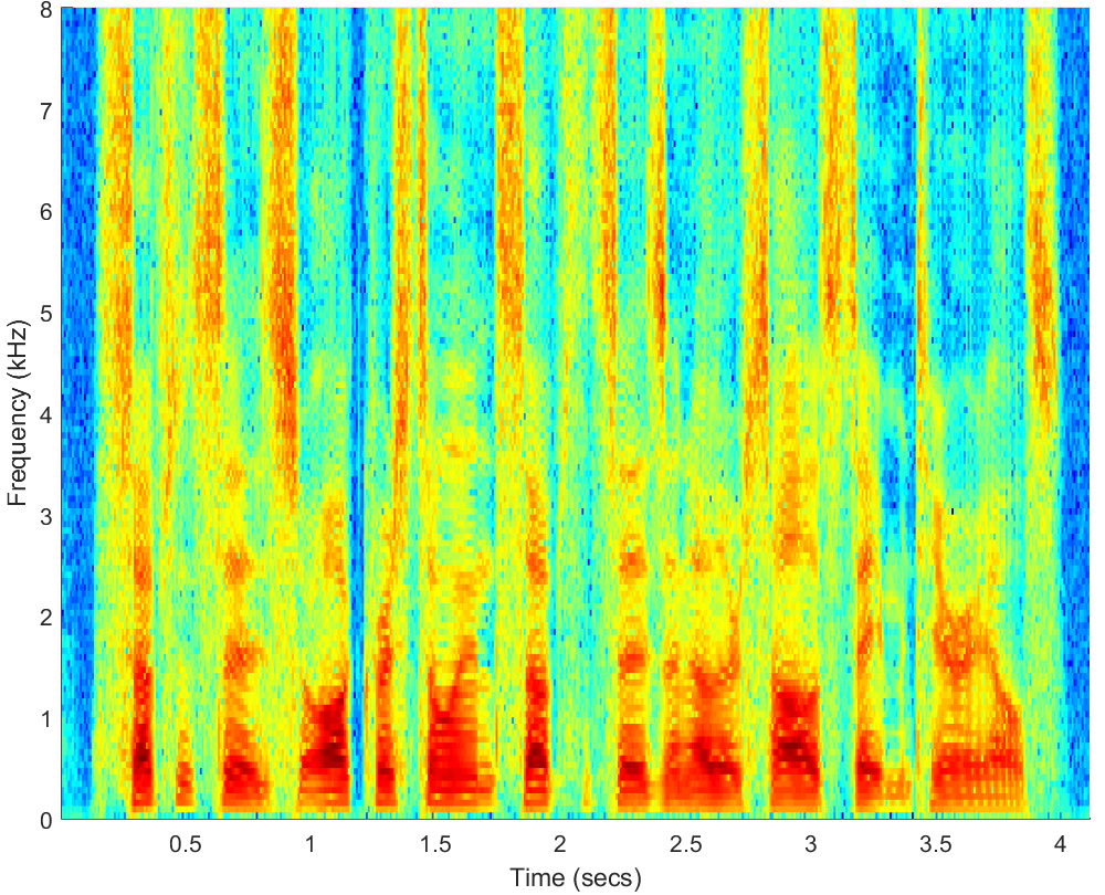 Spectrograms