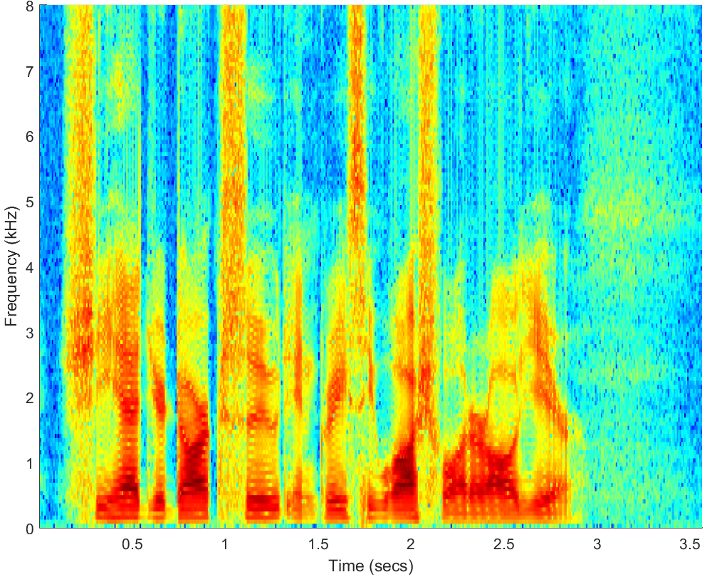 Spectrograms