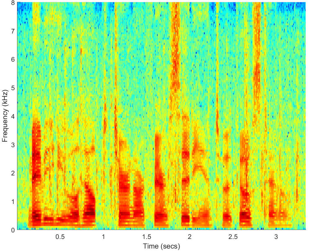 Spectrograms