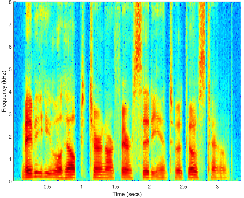 Spectrograms