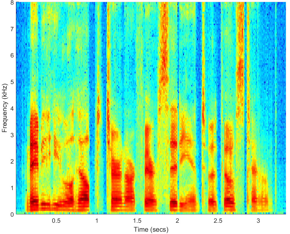 Spectrograms