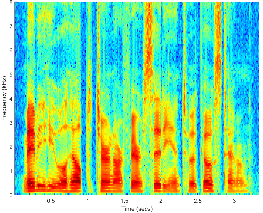 Spectrograms