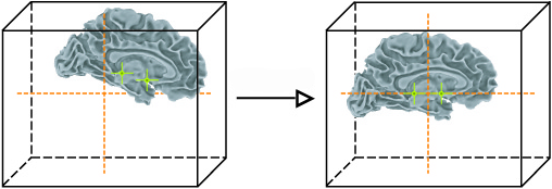 fmri