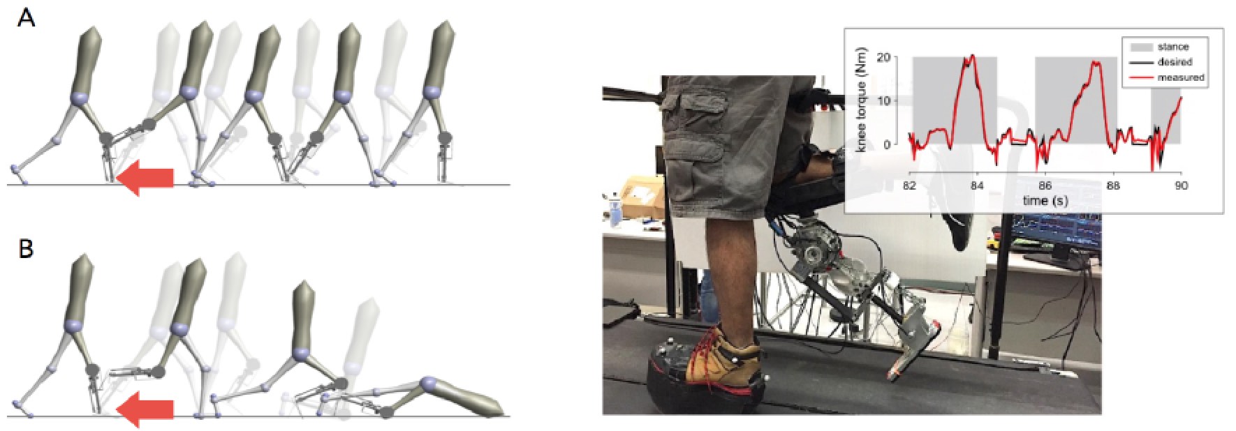 Powered Knee Prosthesis